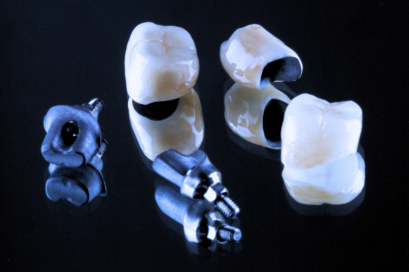 Dental Implants in Windsor