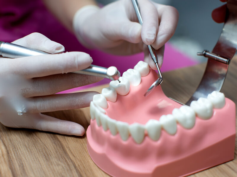 what are dentures? a complete guide for first-time wearers